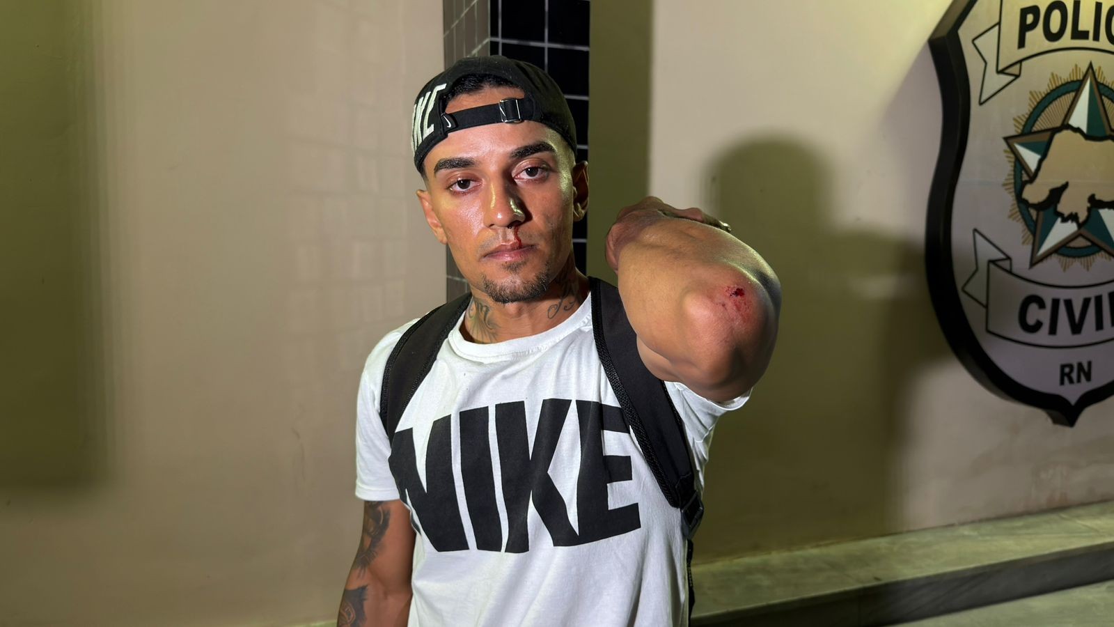 Filho de sargento denuncia ter sido agredido por militar dentro de quartel do Corpo de Bombeiros em Natal