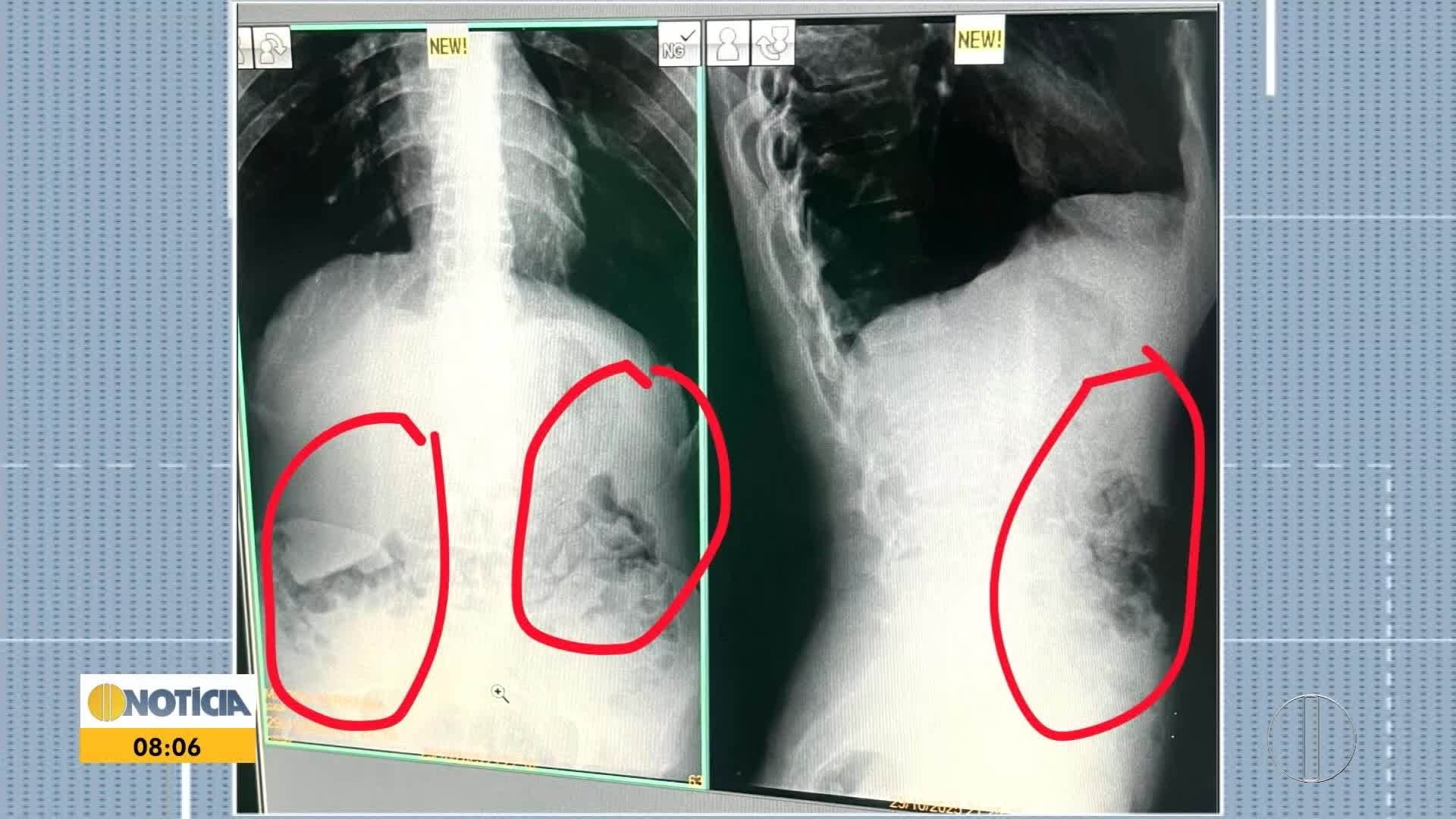 Você Não Tá Convidada pro Meu Bat Mitzvá!