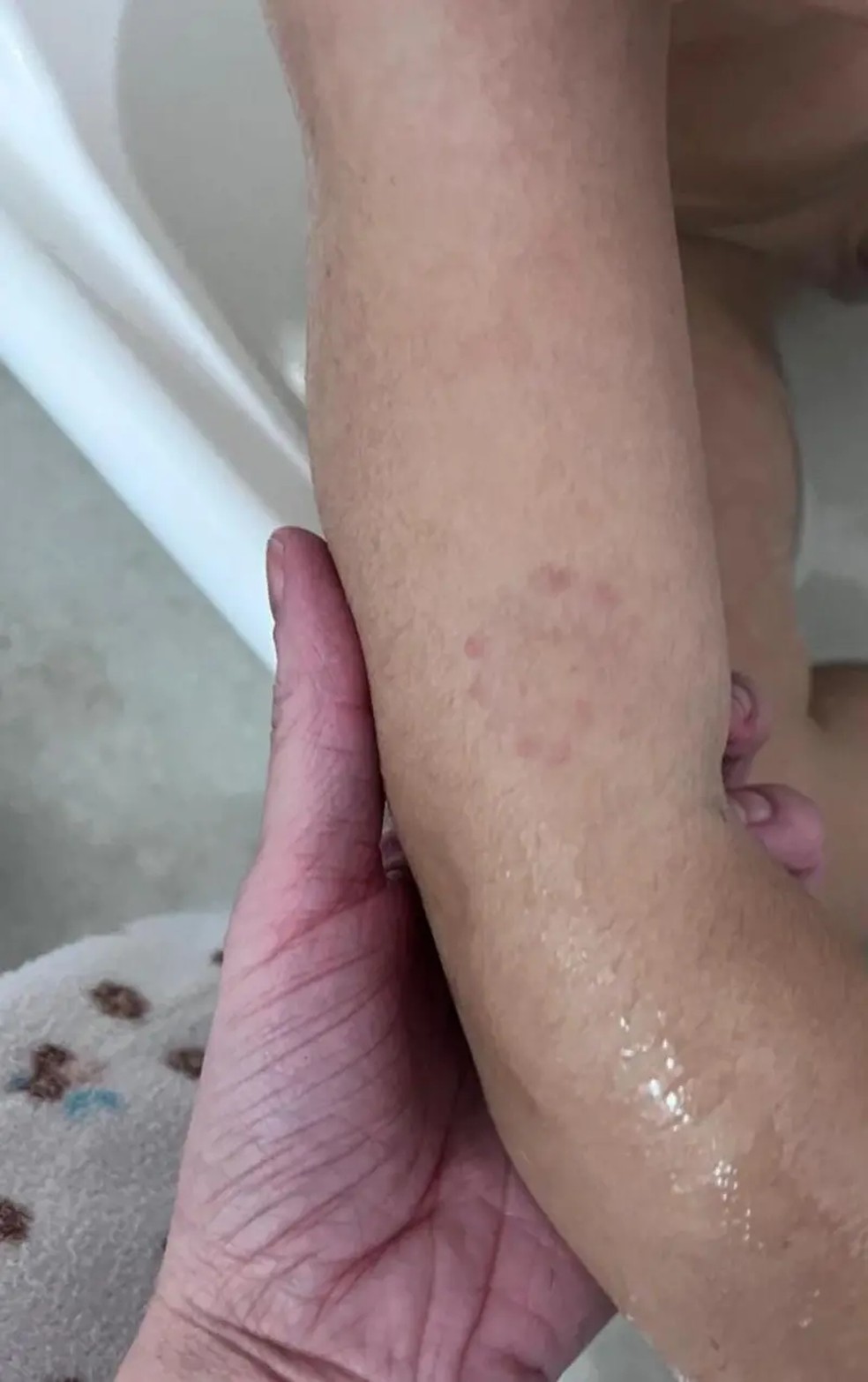 Shaiane procurou a professora de Pedro para perguntar sobre uma marca de mordida, mas ouviu que ninguém viu o que aconteceu e que a criança não choro — Foto: Arquivo pessoal