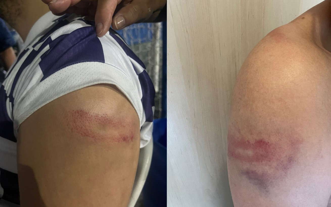 Torcedor do Cruzeiro denuncia agressão da polícia após jogo no Mineirão; VÍDEO