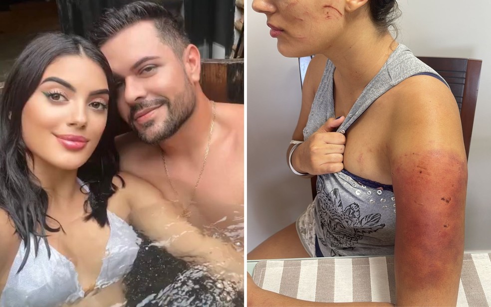 &Agrave; esquerda, Isabella Lacerda ao lado do namorado Thiago Brand&atilde;o Abreu. &Agrave; direita, a jovem com hematomas ap&oacute;s agress&atilde;o &mdash; Foto: Arquivo pessoal/Isabella Lacerda e montagem/g1