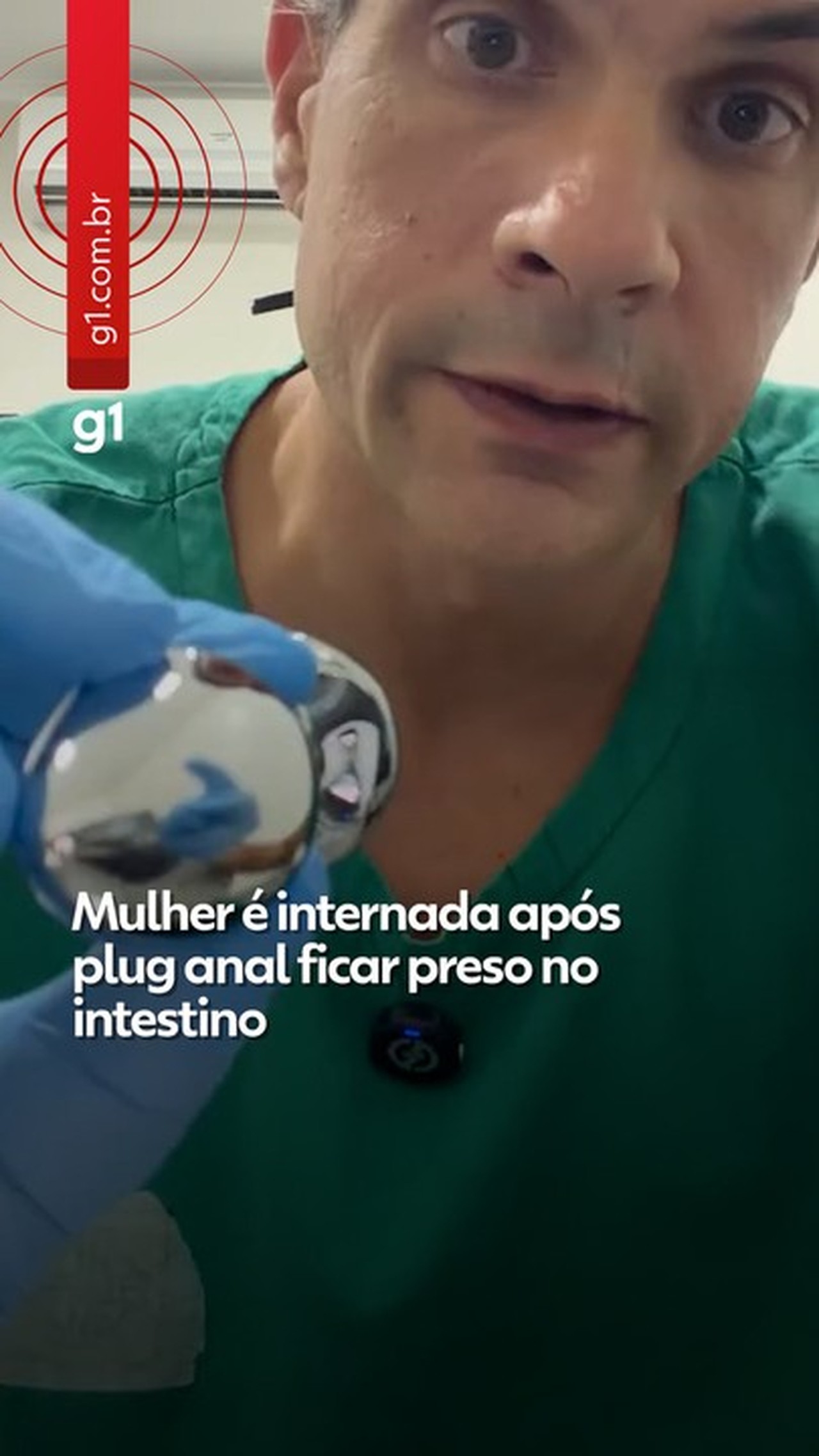 Mulher é internada após plug anal ficar preso no intestino; médicos alertam  para riscos