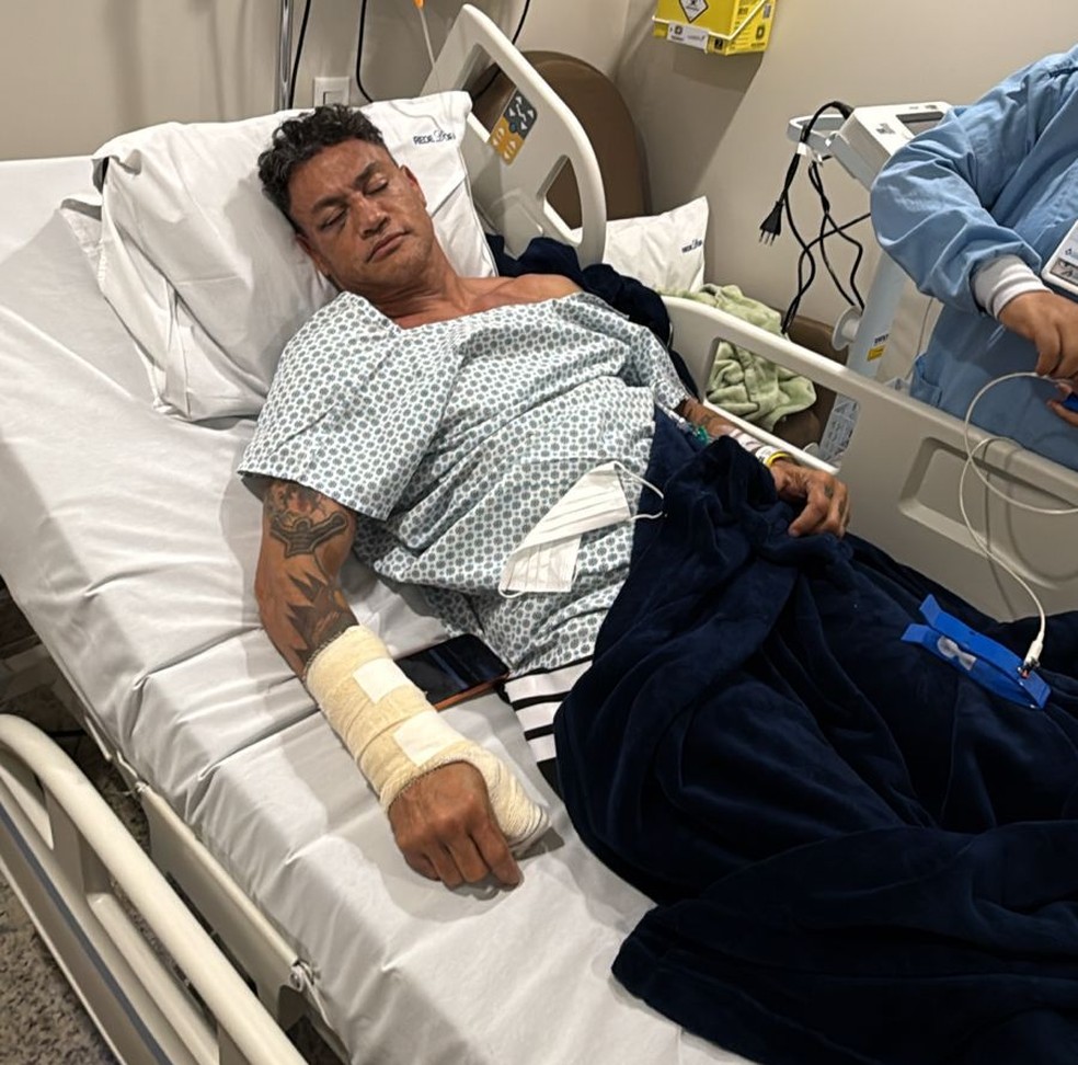 Popó passa por cirurgia na mão após briga generalizada — Foto: Divulgação