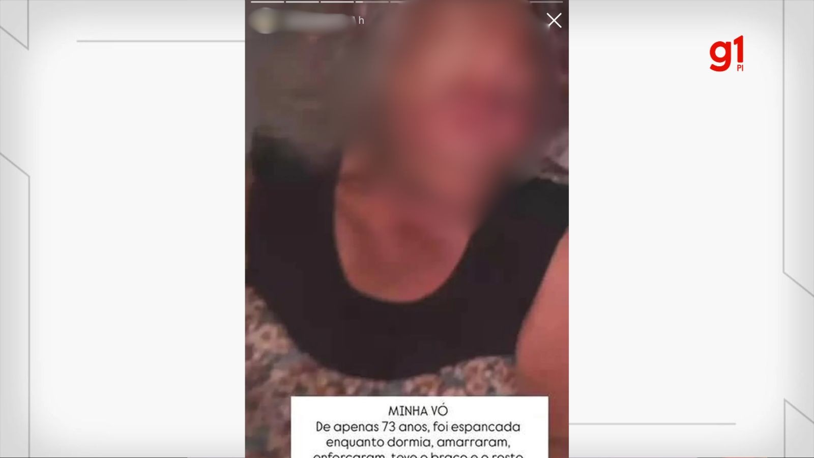 Idosa de 73 anos é amarrada, enforcada e tem ombro deslocado durante roubo no PI; bolsa com R$ 10 mil foi levada