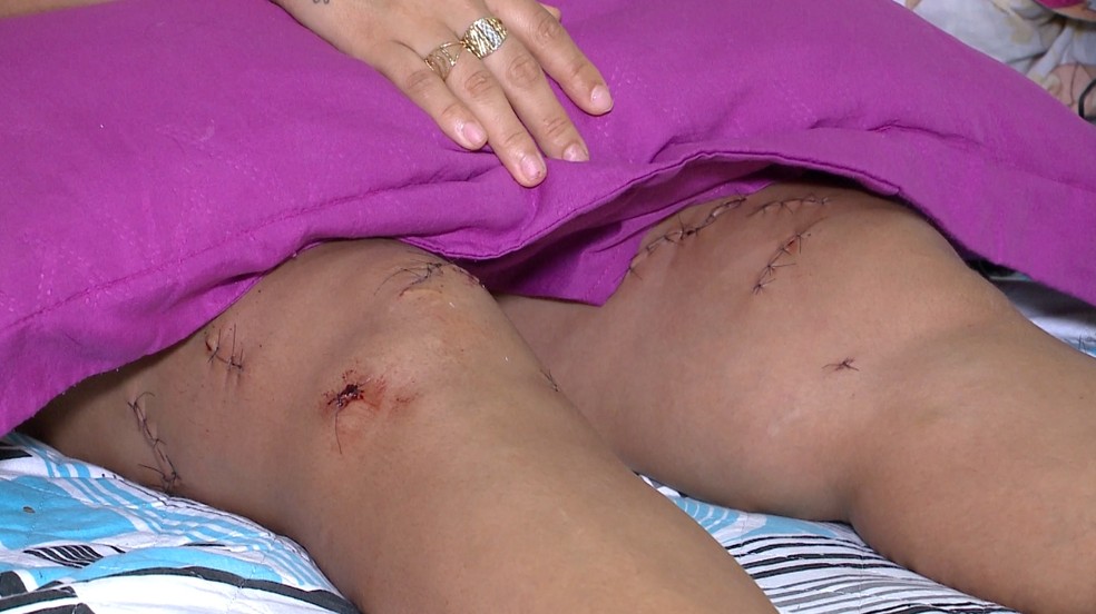 Esteticista sofreu 19 facadas pelo ex-marido, que continua foragido — Foto: Reprodução/TV Clube