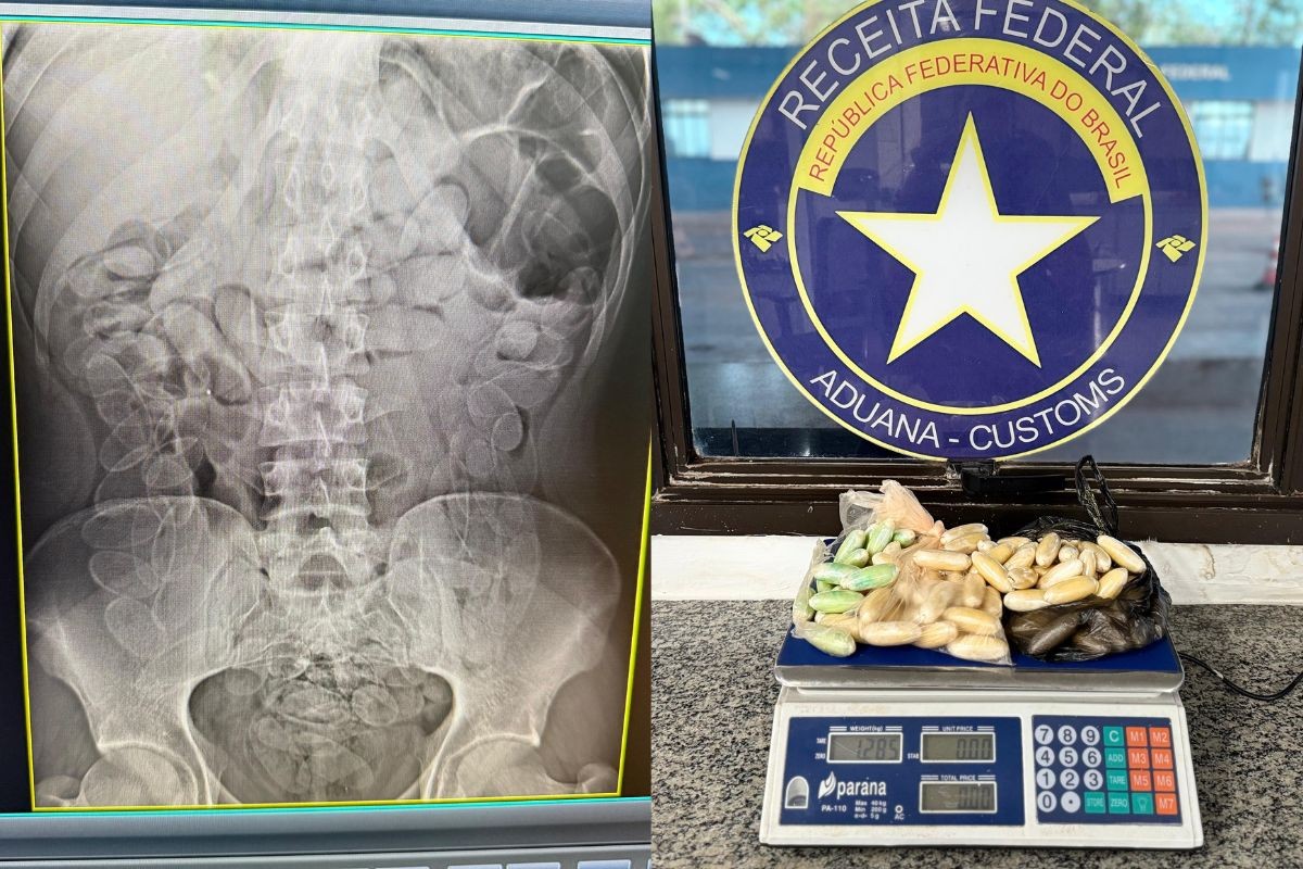 Homem com 90 cápsulas de droga no estômago é preso em operação na fronteira