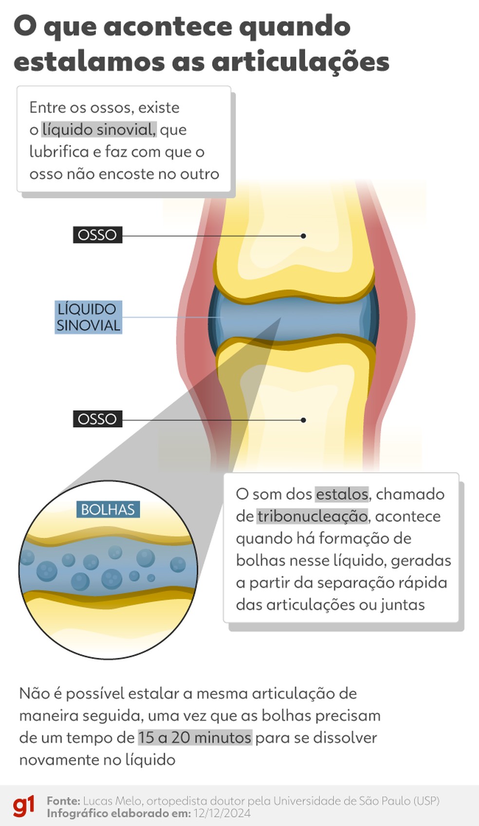 Infográfico mostra o que acontece no corpo quando estalamos as articulações — Foto: Arte/g1