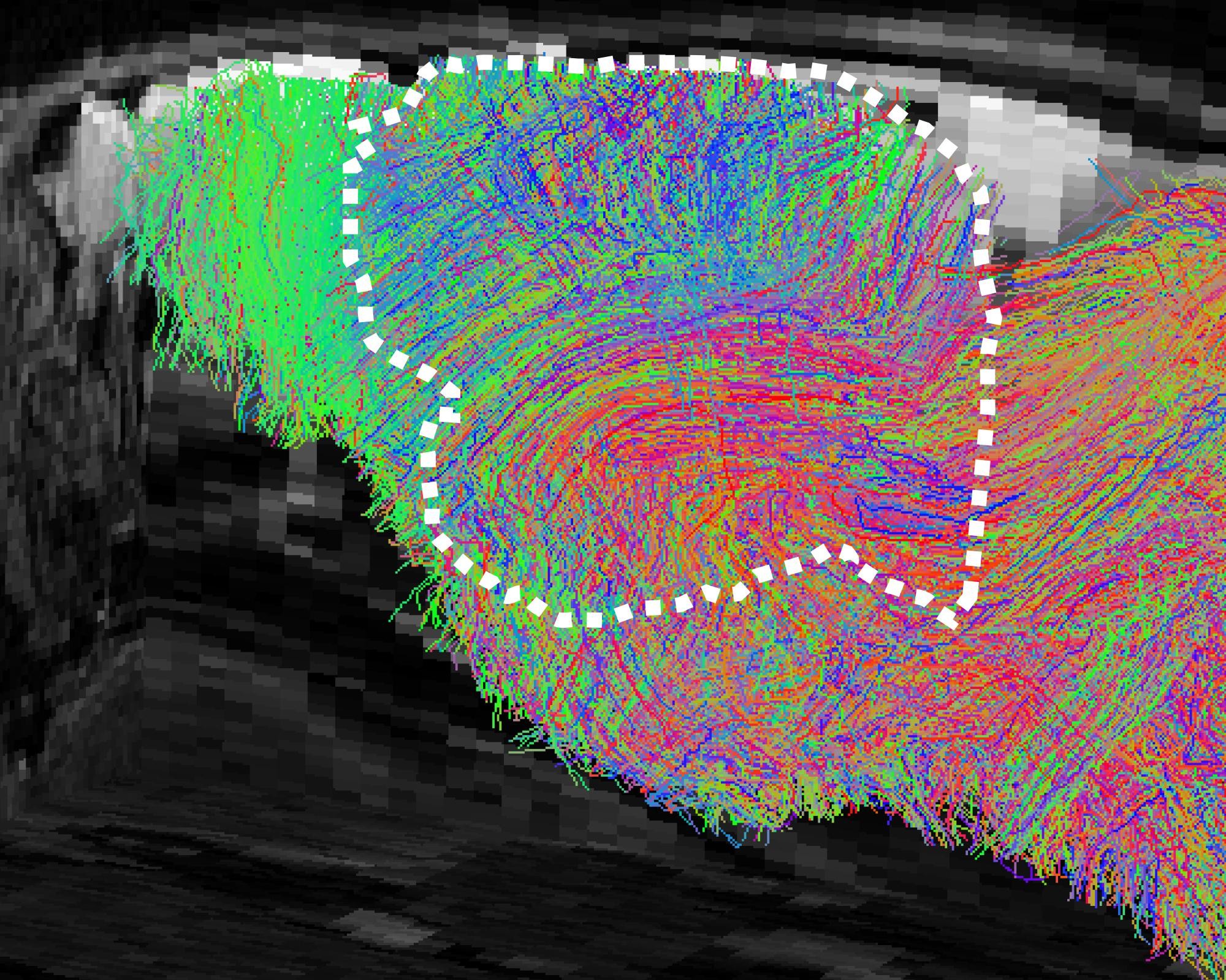 Cientistas fazem ratos com metade do cérebro humano