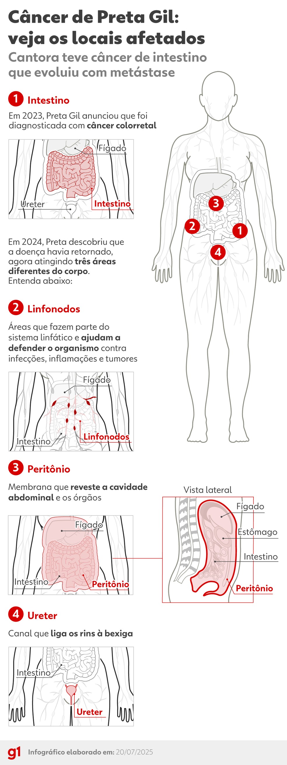 O que é metástase: como células cancerígenas se espalham para outros órgãos  | G1