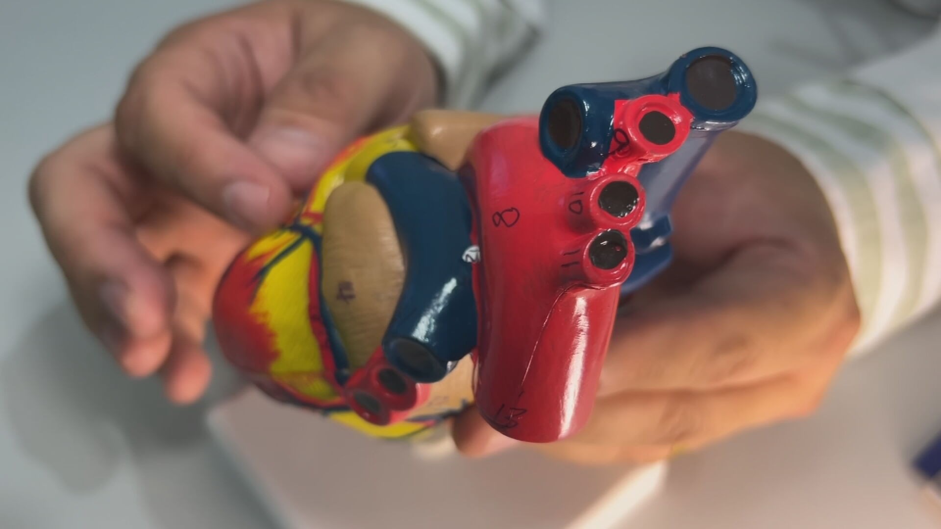 Colesterol alto afeta 14% dos brasileiros e aumenta risco de infarto e AVC; alimentação e exercícios ajudam a controlar