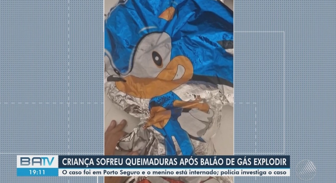 Menino de 3 anos tem rosto e corpo queimados após balão de gás estourar em Porto Seguro: 'Fiquei desesperada', diz mãe