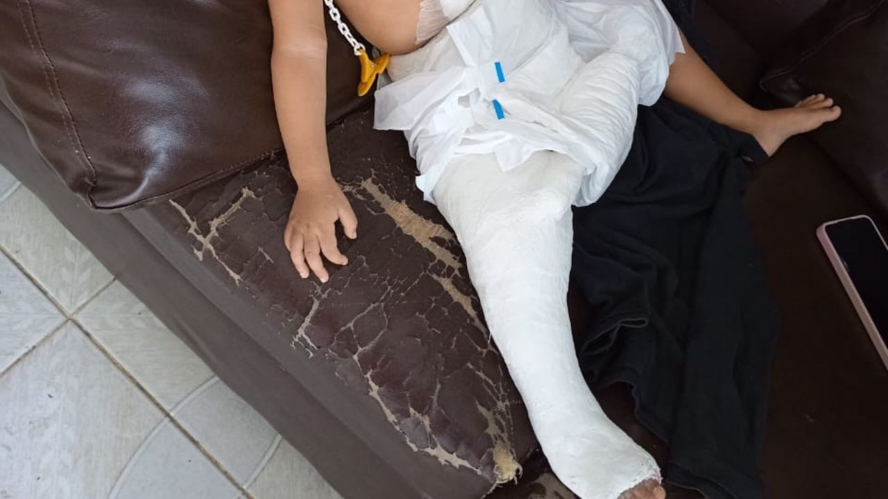 Família denuncia mãe por lesão corporal após criança de 1 ano sofrer fratura na perna em Manaus; VÍDEO