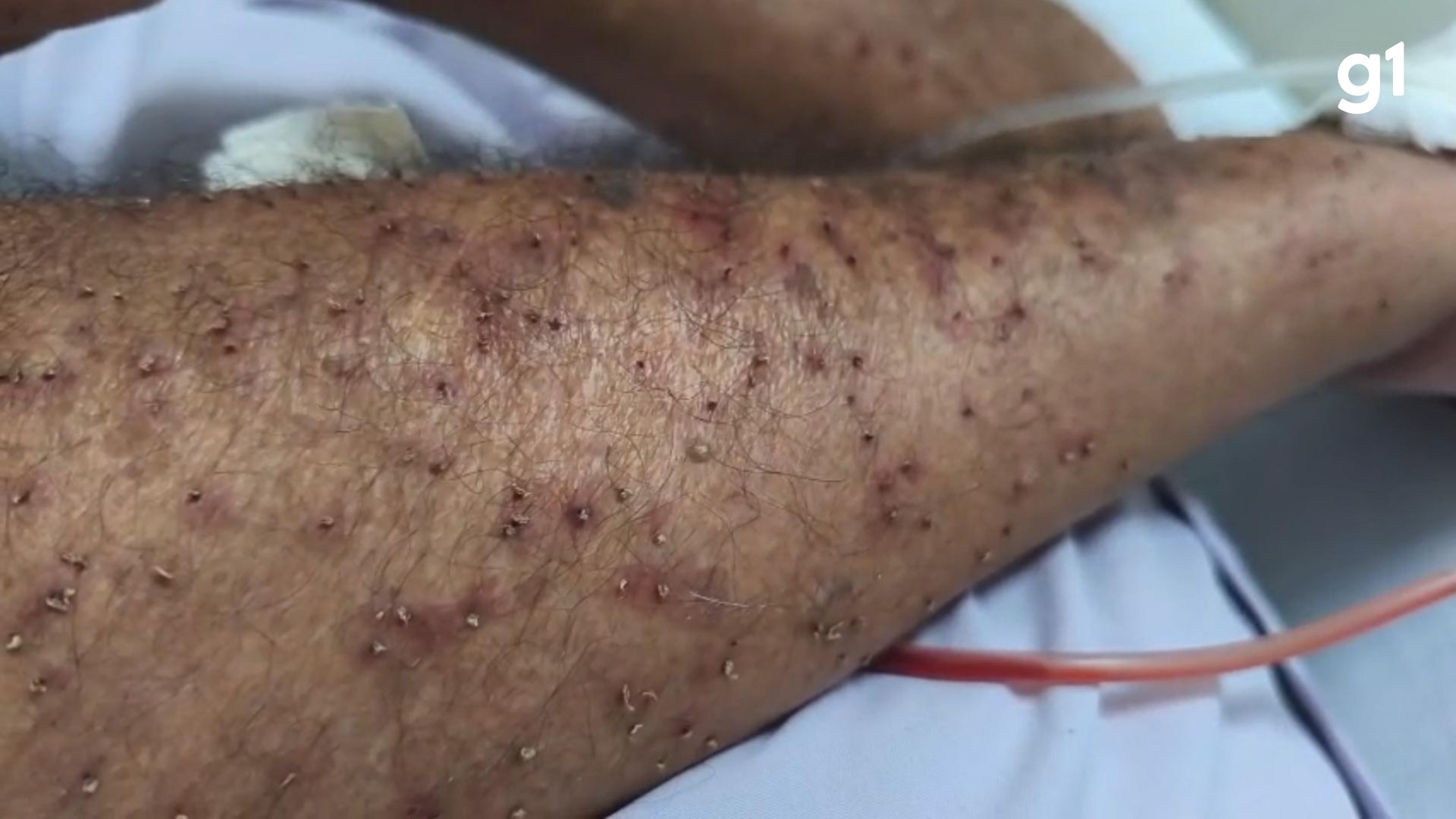 Casal de idosos é atacado por enxame de abelhas em Ponto dos Volantes