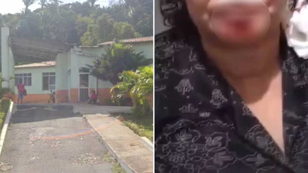 Professor vira réu após arrancar pedaço de queixo da namorada com mordida