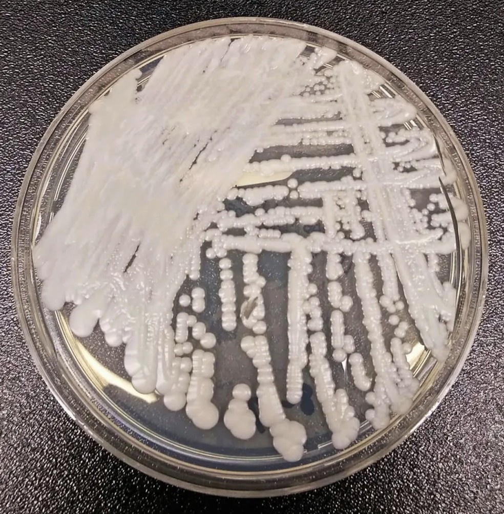 Fungo Candida auris — Foto: Centers For Disease Control and Prevention (CDC)