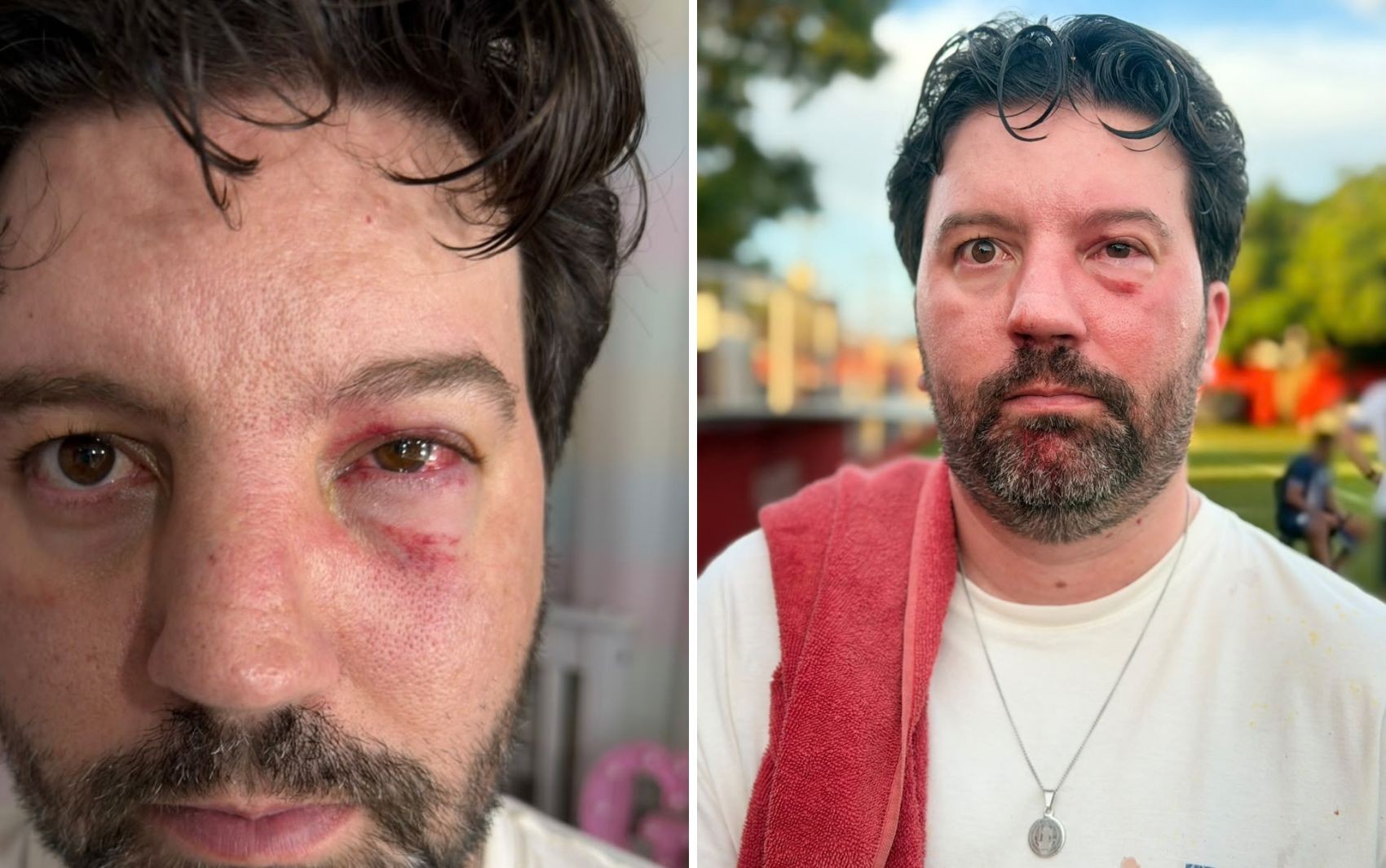 Radialista denuncia agressão de jogador de futebol ao fotografar confusão após jogo