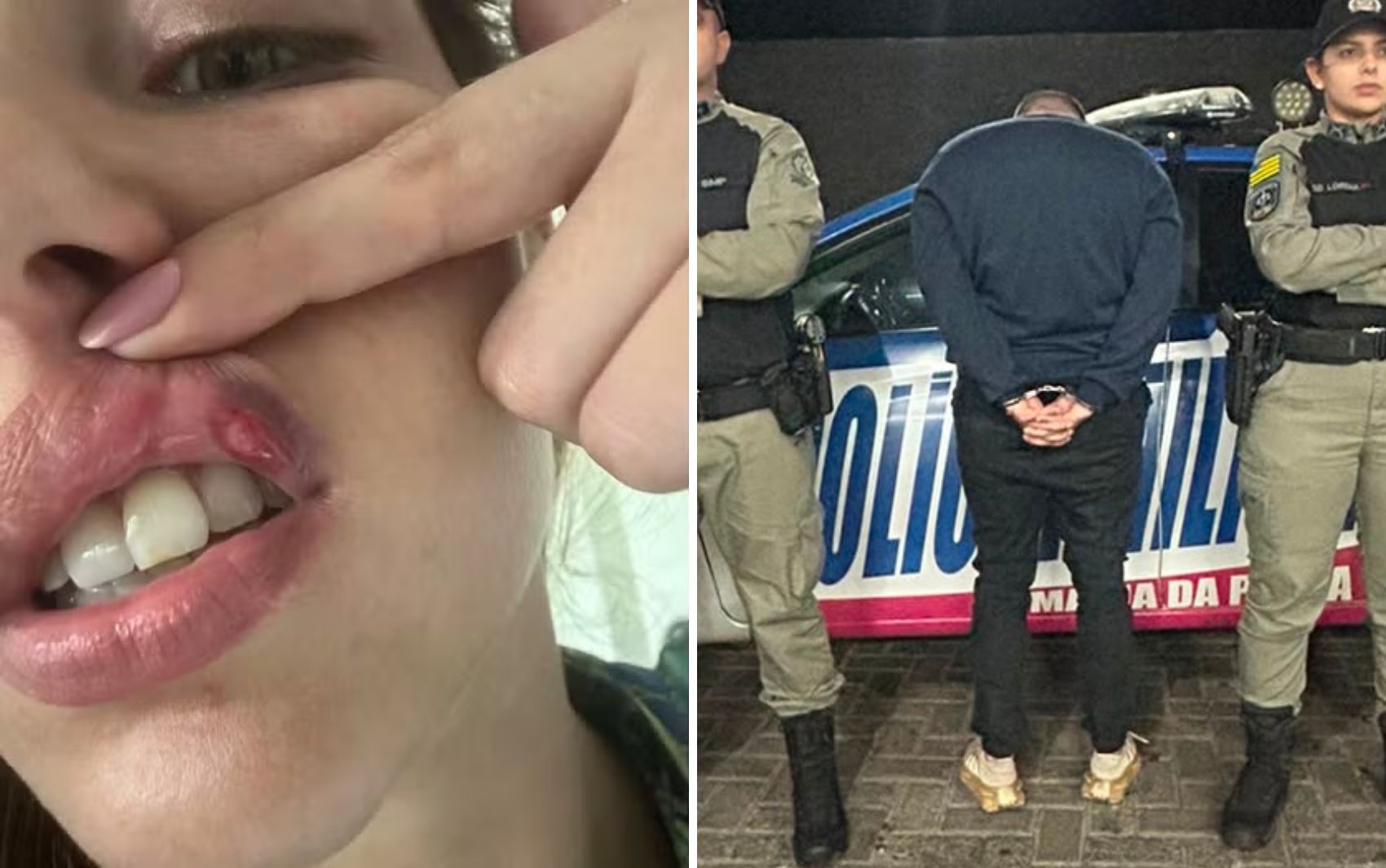 Empresário suspeito de espancar jovem é preso em Goiânia, diz polícia