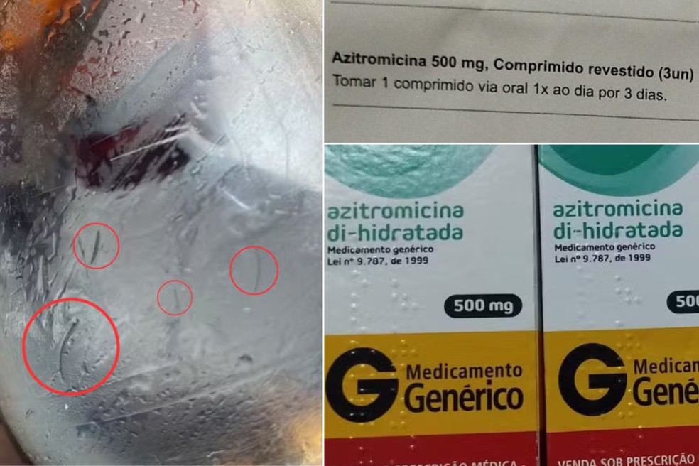Família de Santos (SP) encontra pelos em refrigerante, passa mal e é medicada contra leptospirose — Foto: Reprodução
