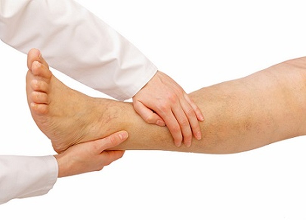 Pés e mãos frias, dores e inchaço nas pernas podem ser sintomas de problemas circulatórios. — Foto: Divulgação/secretaria de Saúde