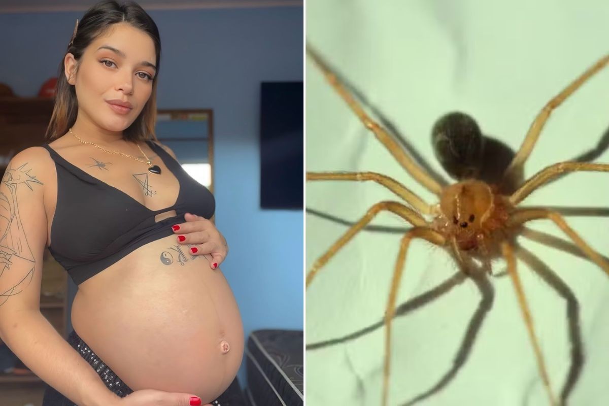 Grávida tem pele da perna necrosada após ser 'picada' por aranha venenosa: 'não conseguia andar'