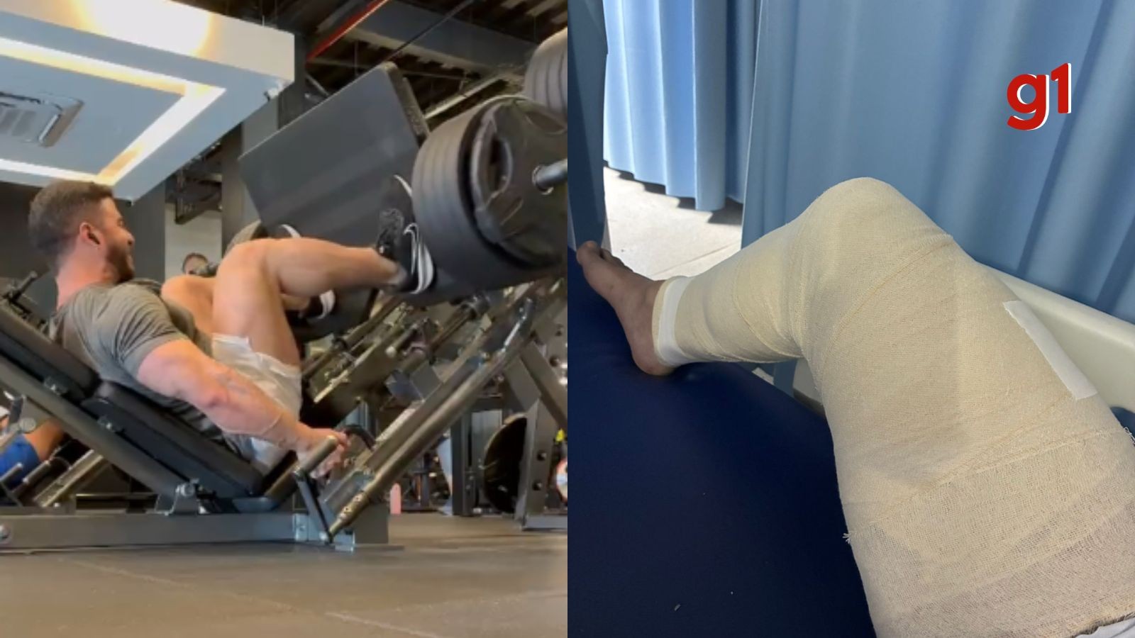Fisiculturista rompe tendão durante treino com 400 kg em academia e passa por cirurgia no Piauí