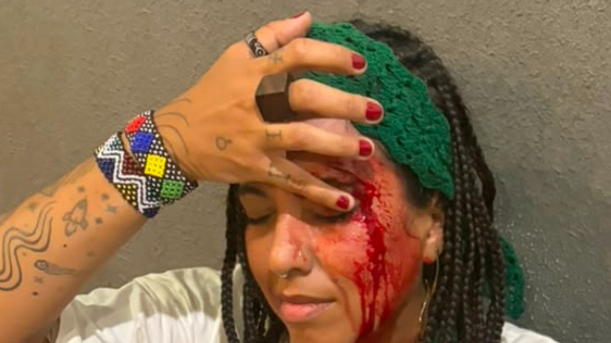 Influenciadora é agredida em samba na  Lapa; advogada diz que agressor saiu rindo e debochando