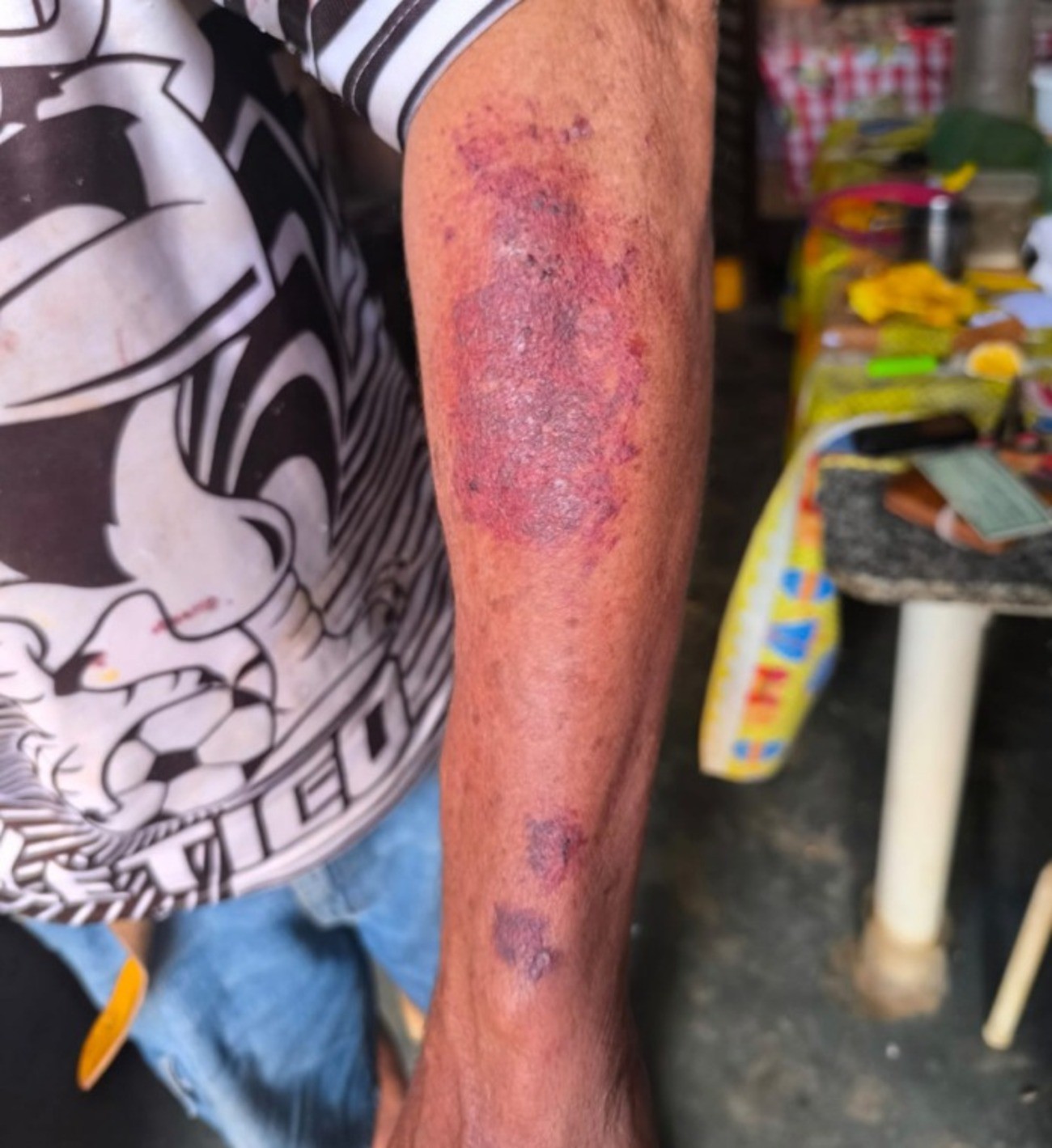 Aposentado é agredido com mata-leão, socos e chutes durante tentativa de assalto em MG