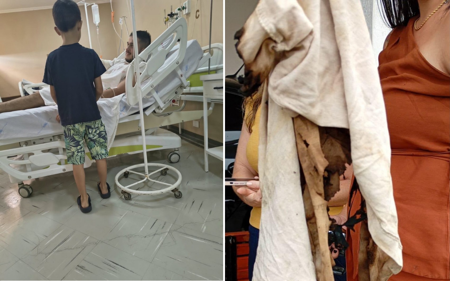 Acidente com fogo em festa de escola deixa 4 feridos em Orlândia, SP