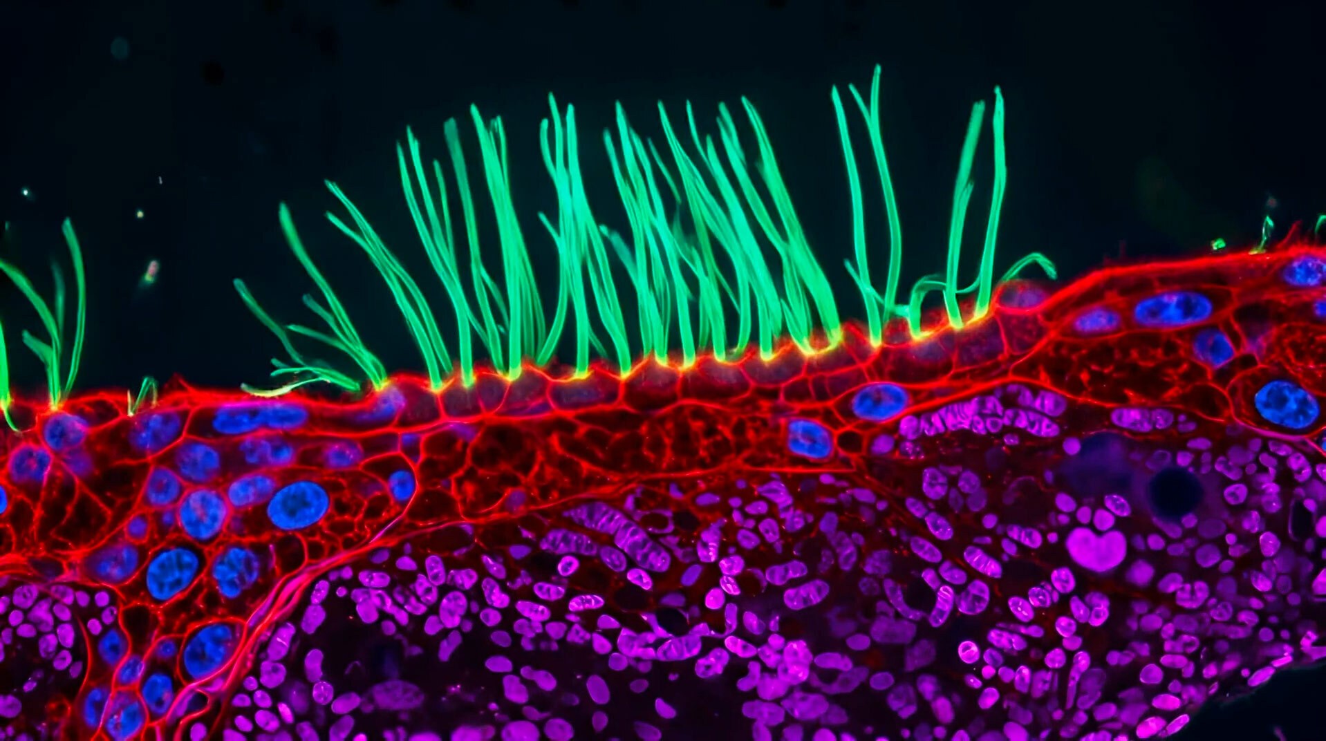 VÍDEO: Imagens das vias aéreas de uma criança vencem prêmio de registros microscópicos