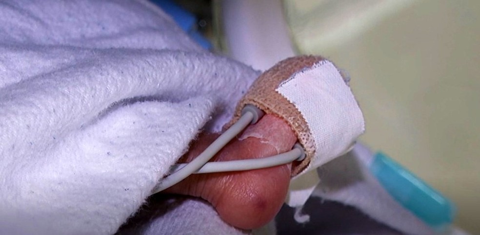 Bebês prematuros chegam a ficar meses hospitalizados — Foto: Reprodução/TVMorena