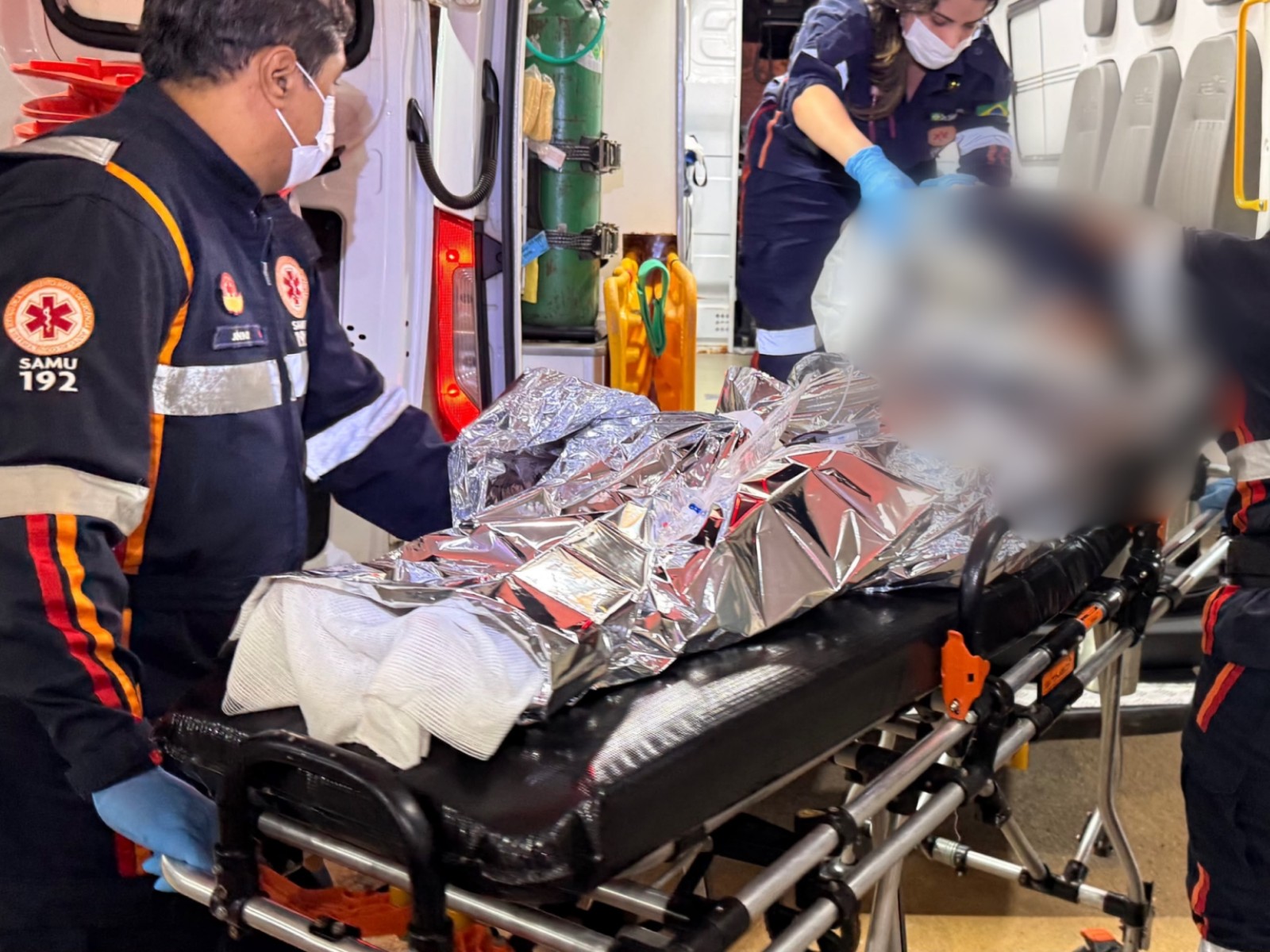 Adolescente que teve 80% do corpo queimado em explosão com álcool tem perna amputada no AC