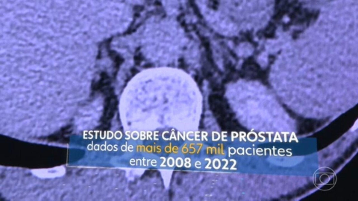 Câncer de próstata: estudo com mais de 650 mil pacientes brasileiros traz dados inéditos sobre o diagnóstico e tratamento