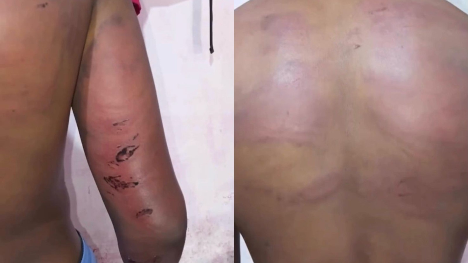 SSP afasta policial após denúncia de tortura contra adolescente no MA