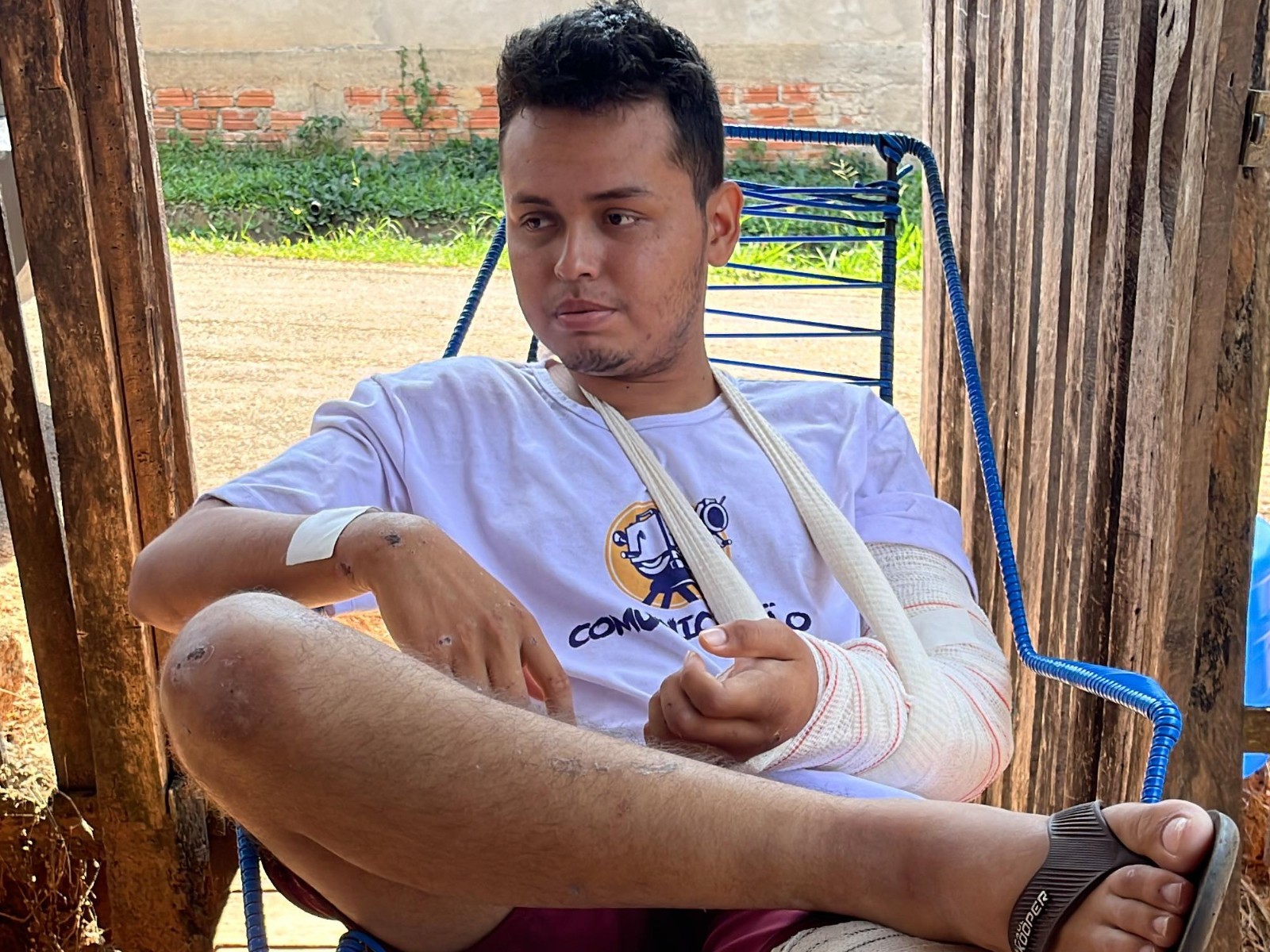 Repórter que foi para UTI após acidente grave tem alta de hospital no Acre: 'Pensei que era um sonho'
