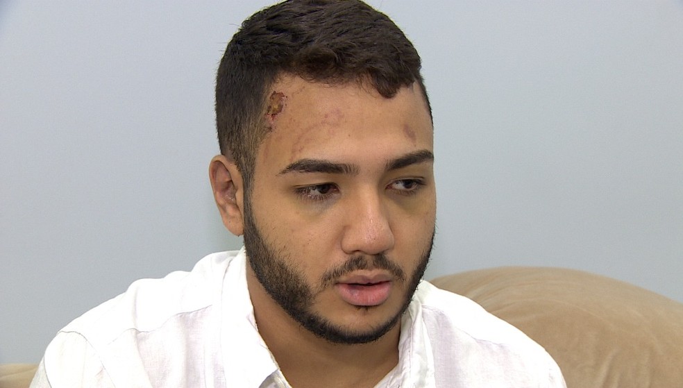 Jovem ficou agredido após defender prima em bloco de carnaval — Foto: Reprodução/Rede Amazônica