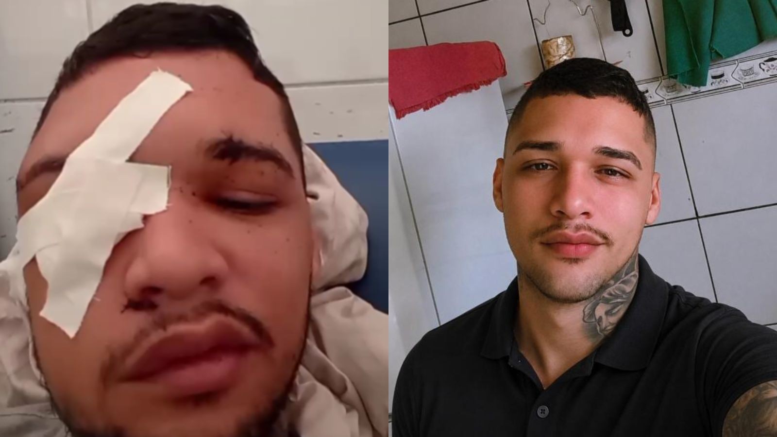 Jovem baleado duas vezes na cabeça afirma ter sido confundido com parente; polícia investiga