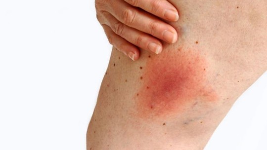 5 sinais na pele que podem indicar problemas de saúde 