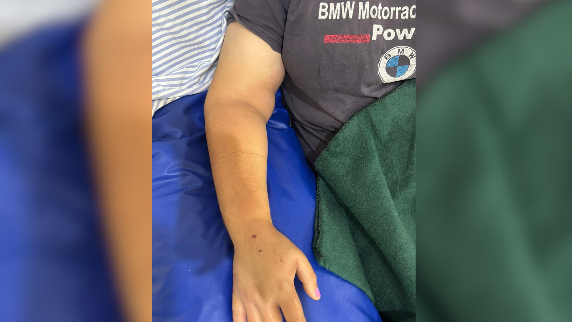 Mulher é picada por cobra jararaca enquanto colhia abóboras em sítio no interior de SP