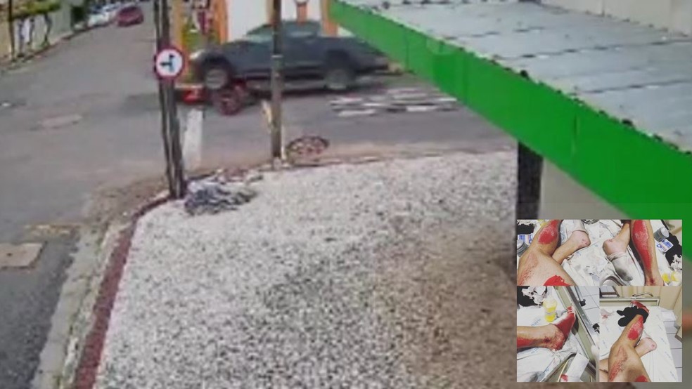 Motociclista ficou com ferimentos nas pernas após ser atropelado por motorista durante discussão no trânsito em Fortaleza. — Foto: Arquivo pessoal