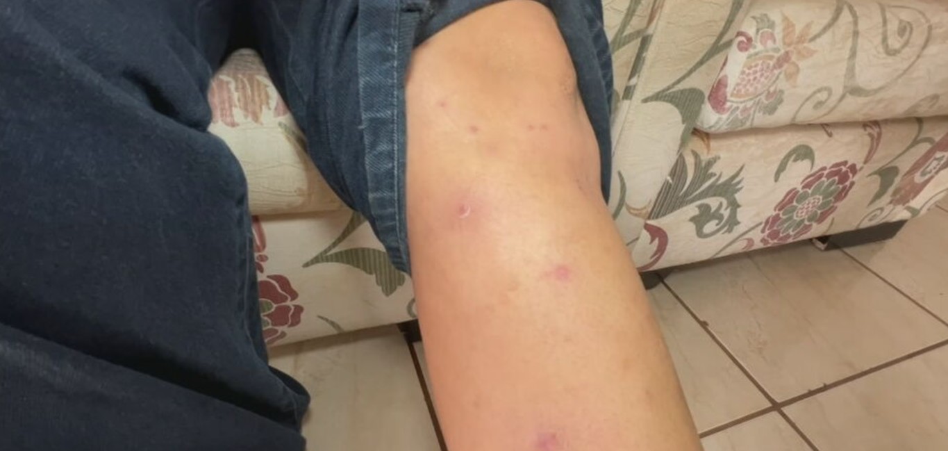 Inverno requer cuidados para pele saudável