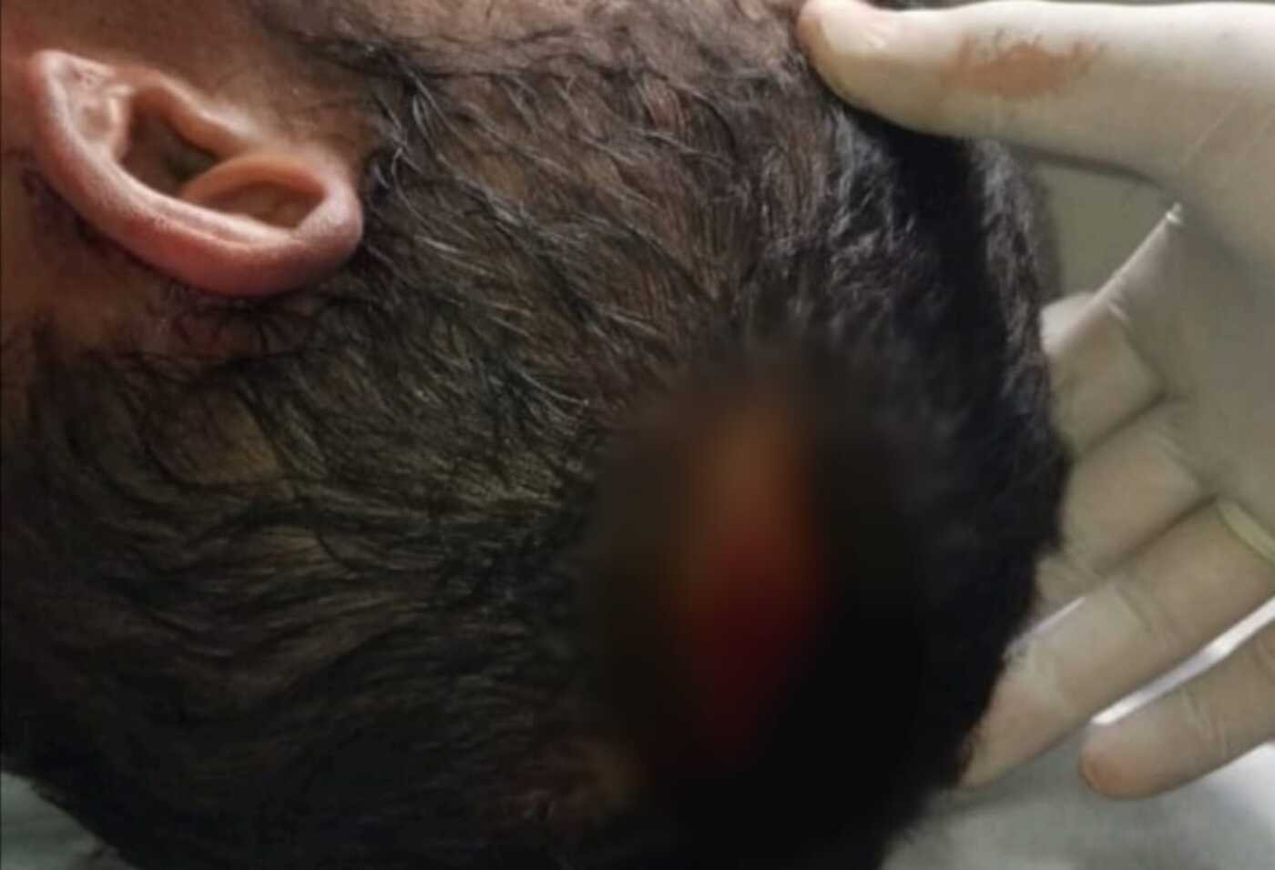 Pedreiro é agredido com facão quando trabalhava em obra; suspeito foi preso