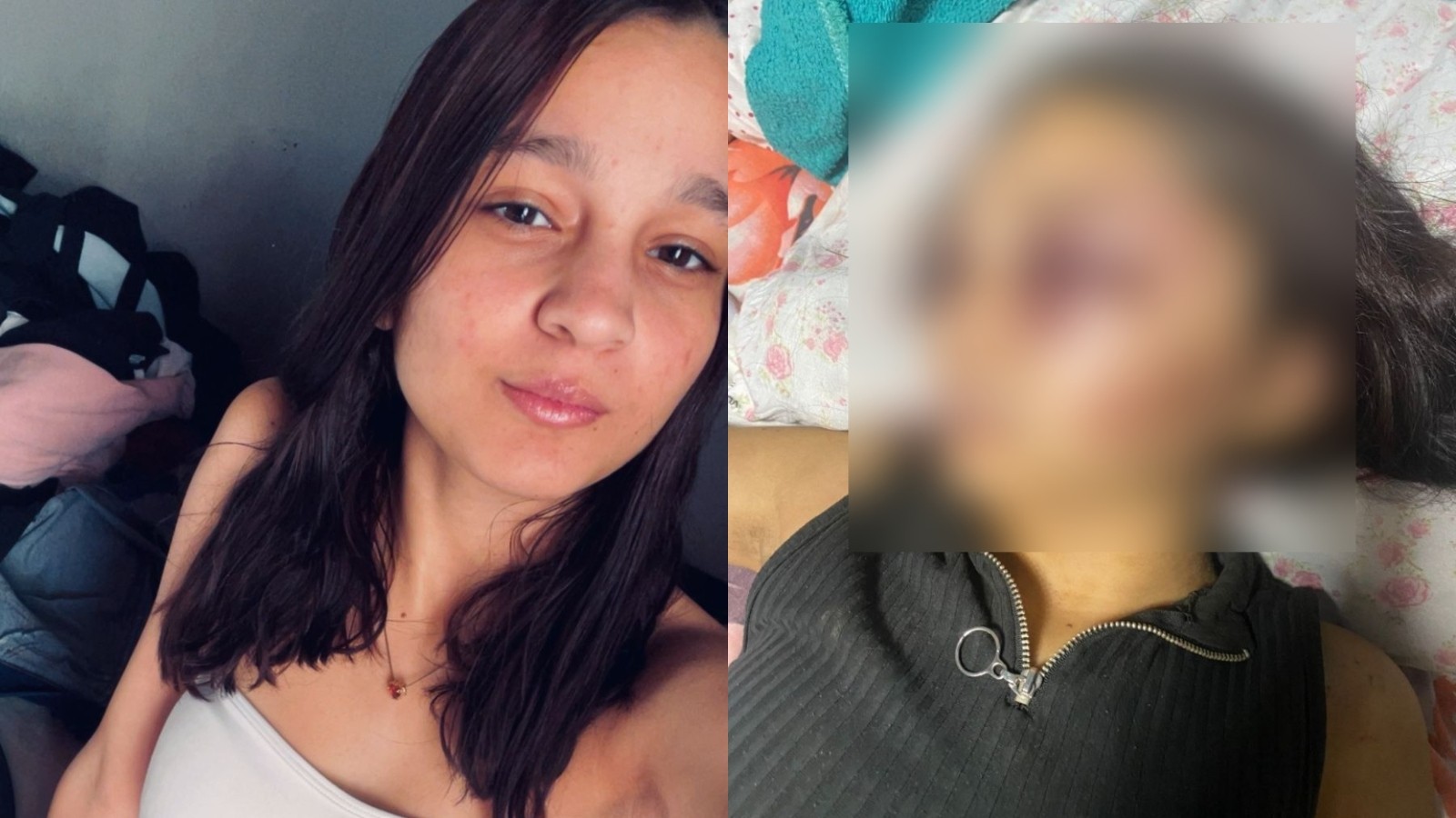 Adolescente é sequestrada e tem rosto desfigurado após agressões de namorado no Ceará