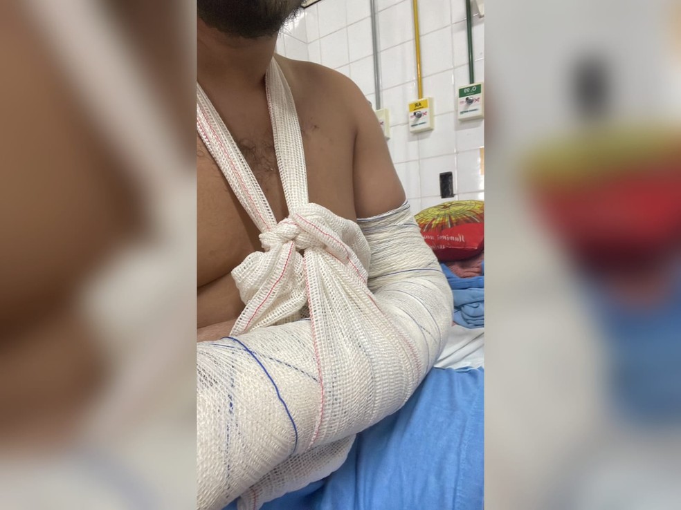 O fotógrafo Renan Christiane Gonçalves Matos, de 27 anos, quebrou o braço após ser atropelado por motorista de 18 anos na saída de boate, em Fortaleza. — Foto: Arquivo pessoal