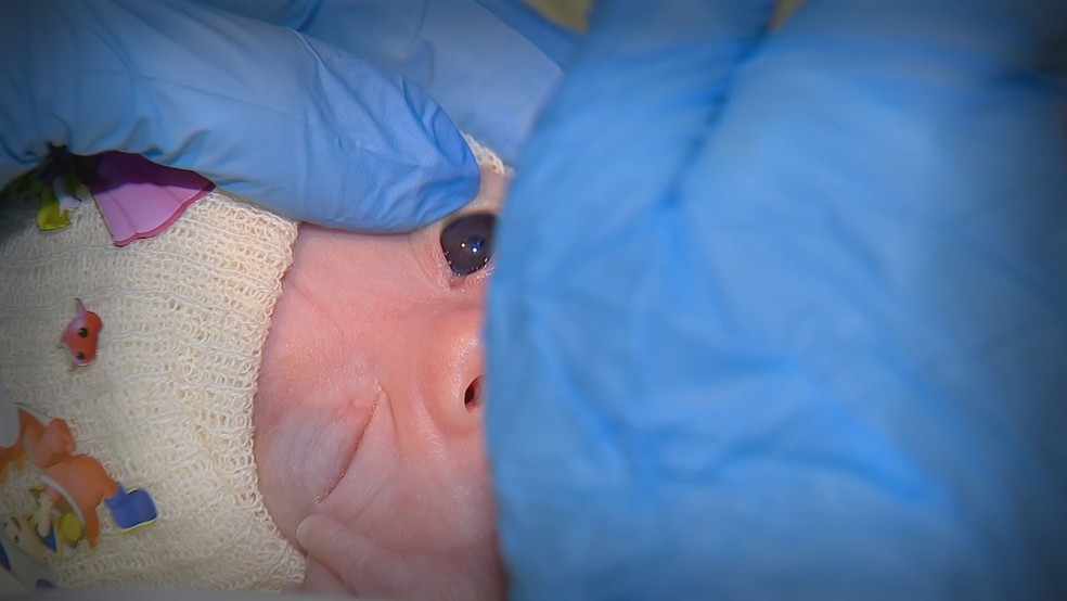 Diagnóstico precoce é essencial para detectar doenças nos olhos dos bebês prematuros — Foto: Reprodução/TV TEM