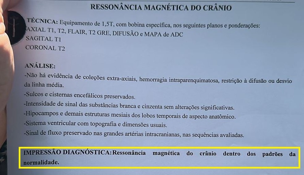 Ressonância magnética constatou que jovem de 18 anos, que fingiu ter câncer para arrecadar dinheiro no Ceará, não estava com a doença. — Foto: Reprodução