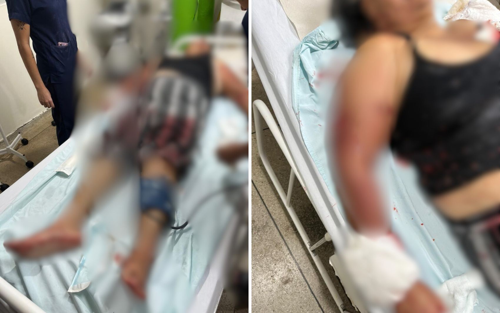 Avó atacada por pit bull isolou neta bebê em quarto e precisou trancar porta da casa para se livrar de mordidas do cão, diz polícia