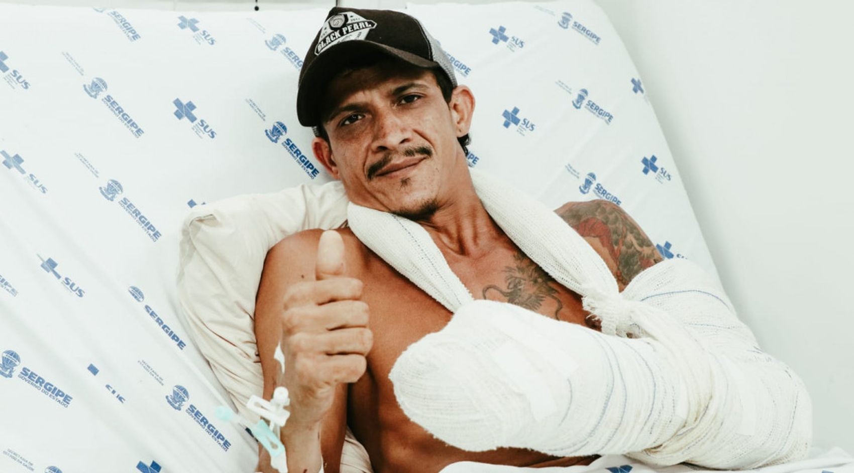 'Estou muito feliz por ter minha mão de volta', diz paciente após cirurgia de reimplante em Sergipe