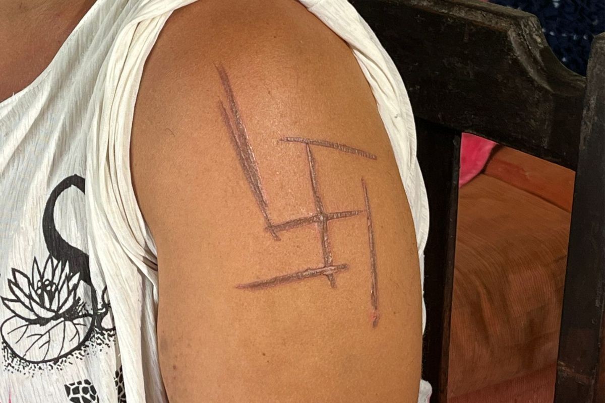 'Tenho que trocar a minha pele', diz mulher trans marcada com símbolo nazista durante tortura em MS
