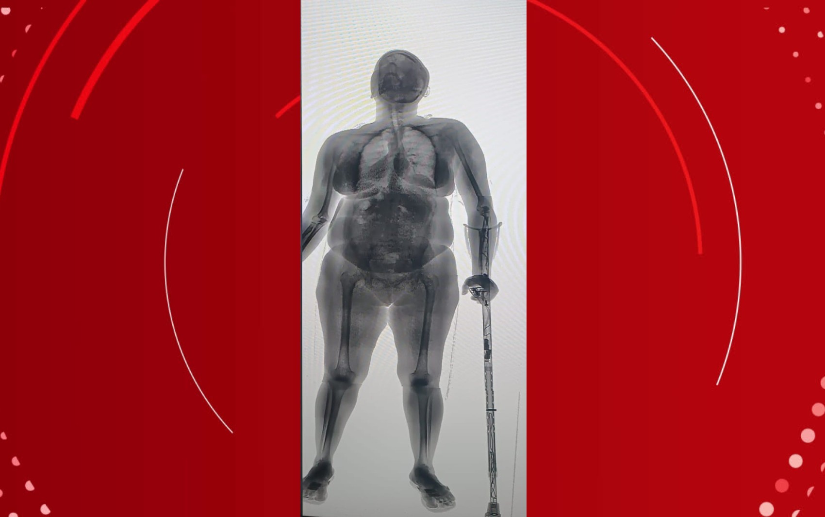 Idosa é flagrada ao tentar entrar em presídio com drogas e eletrônicos na muleta