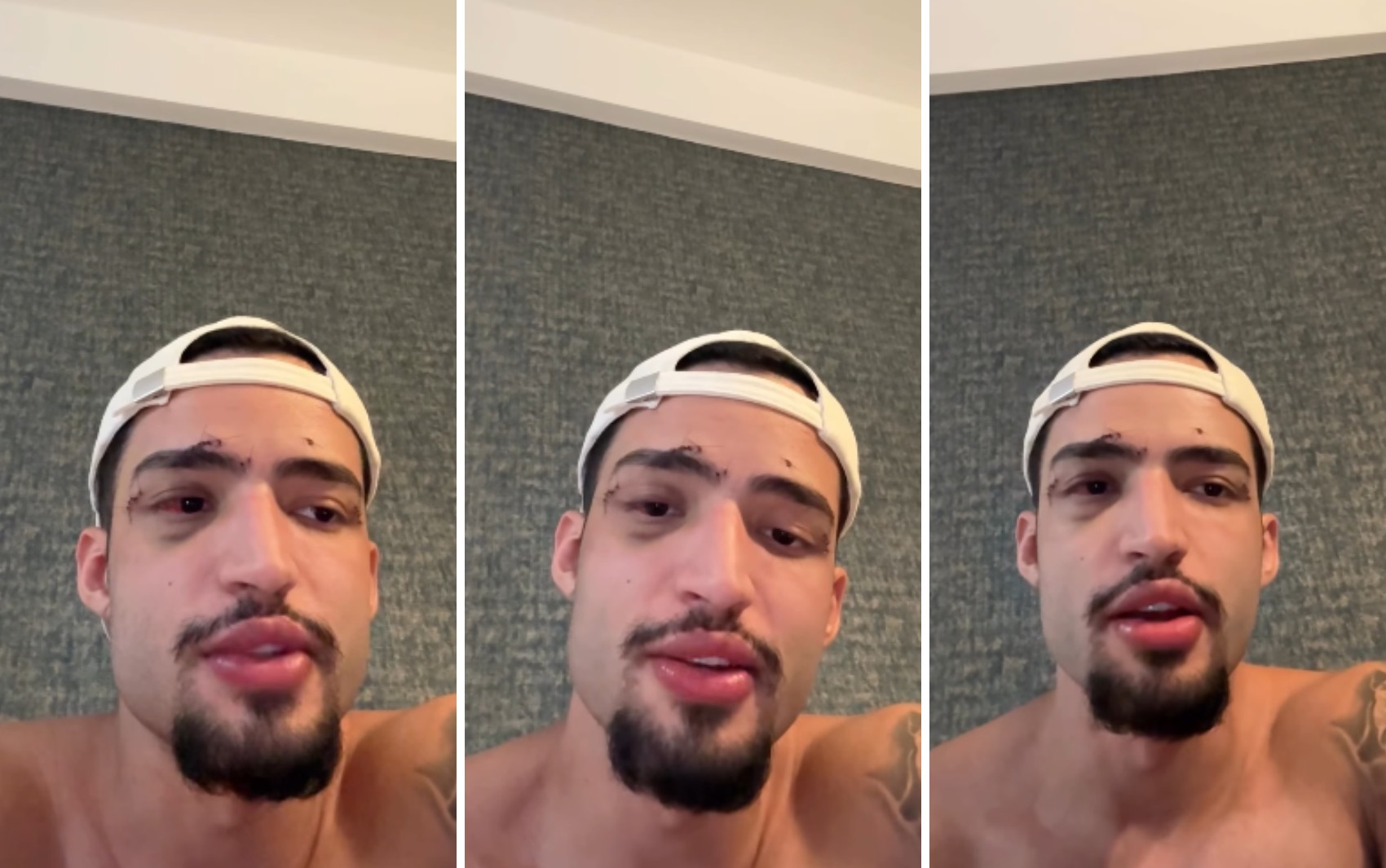 'Não sei o que aconteceu', diz brasileiro resgatado inconsciente de piscina em que amigo foi achado morto na Grécia